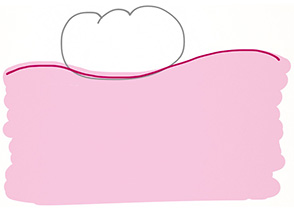 periodoncia